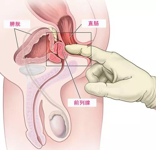 看完这篇前列腺G点科普,算是真正掌握了男人第二快感-同趣社TongQoo-在这里,遇见和你一样有趣的“同类”